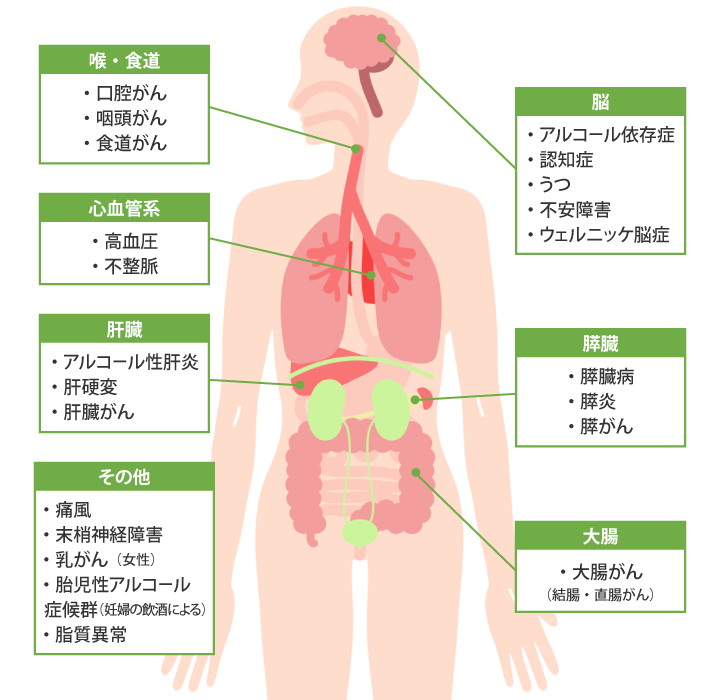 アルコールがもたらす代表的な疾患